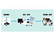 超音波骨密度検査